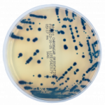ANNAR-MG-Diagnostica-3-300x193